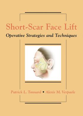 Tonnard / Verpaele |  Short-Scar Face Lift | Buch |  Sack Fachmedien