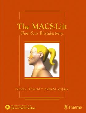 Tonnard / Verpaele |  The Macs-Lift | Buch |  Sack Fachmedien