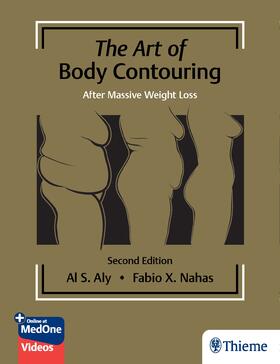 Aly / Nahas |  The Art of Body Contouring: After Massive Weight Loss | Buch |  Sack Fachmedien
