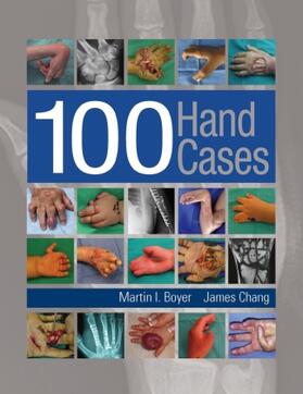 Boyer / Chang |  Boyer, M: 100 Hand Cases | Buch |  Sack Fachmedien