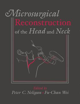Neligan / Wei |  Microsurgical Reconstruction of the Head and Neck | Buch |  Sack Fachmedien