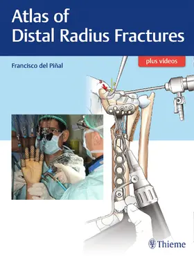 Del Pinal |  Atlas of Distal Radius Fractures | Buch |  Sack Fachmedien