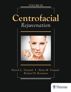 Tonnard / Verpaele / Bensimon |  Tonnard, P: Centrofacial Rejuvenation | Buch |  Sack Fachmedien