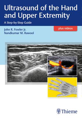 Fowler / Rawool |  Ultrasound of the Hand and Upper Extremity | Buch |  Sack Fachmedien
