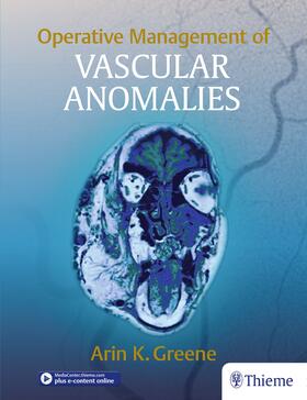 Greene |  Operative Management of Vascular Anomalies | Buch |  Sack Fachmedien