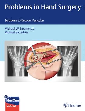 Neumeister / Sauerbier |  Problems in Hand Surgery | Buch |  Sack Fachmedien