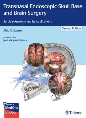 Stamm |  Transnasal Endoscopic Skull Base and Brain Surgery | Buch |  Sack Fachmedien