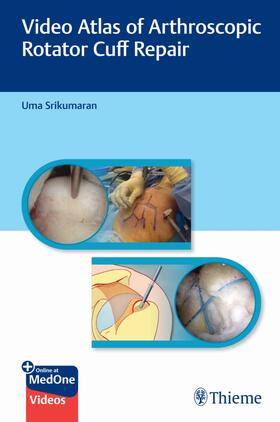 Srikumaran |  Video Atlas of Arthroscopic Rotator Cuff Repair | Buch |  Sack Fachmedien