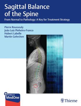 Roussouly / Pinheiro-Franco / Labelle |  Sagittal Balance of the Spine | Buch |  Sack Fachmedien