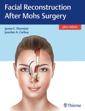 Thornton / Carboy |  Facial Reconstruction After Mohs Surgery | Buch |  Sack Fachmedien