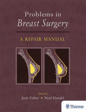 Fisher / Handel |  Problems in Breast Surgery | eBook | Sack Fachmedien