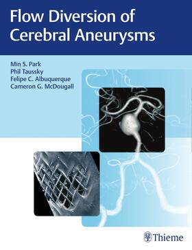 Park / Taussky / Albuquerque |  Flow Diversion of Cerebral Aneurysms | Buch |  Sack Fachmedien
