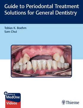 Chui / Boehm |  Guide to Periodontal Treatment Solutions for General Dentistry | Buch |  Sack Fachmedien