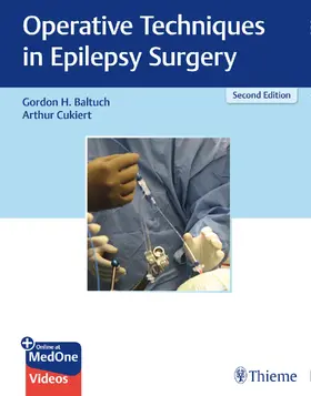 Baltuch / Cukiert |  Operative Techniques in Epilepsy Surgery | Buch |  Sack Fachmedien