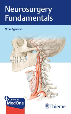 Agarwal |  Neurosurgery Fundamentals | Buch |  Sack Fachmedien