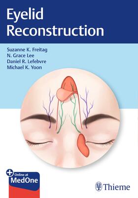 Freitag / Lee / Lefebvre |  Eyelid Reconstruction | Buch |  Sack Fachmedien