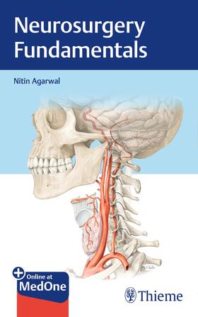 Agarwal |  Neurosurgery Fundamentals | eBook | Sack Fachmedien