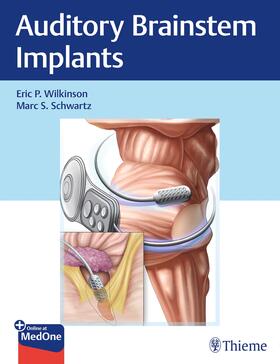 Wilkinson / Schwartz |  Auditory Brainstem Implants | eBook | Sack Fachmedien