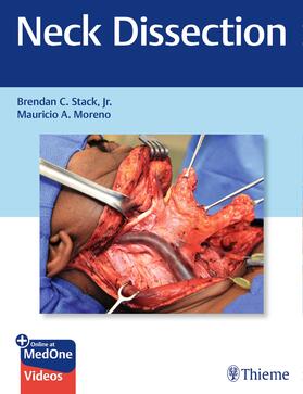 Stack, Jr. / Jr. / Moreno |  Neck Dissection | eBook | Sack Fachmedien