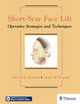 Tonnard / Verpaele |  Short-Scar Face Lift | eBook | Sack Fachmedien