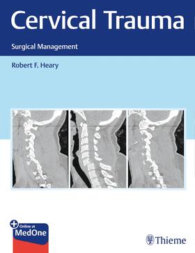 Heary |  Cervical Trauma | Buch |  Sack Fachmedien