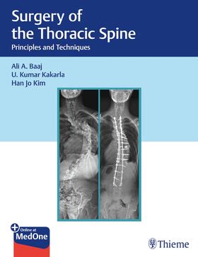 Baaj / Kakarla / Kim |  Surgery of the Thoracic Spine | Buch |  Sack Fachmedien