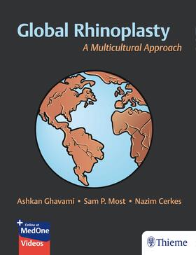 Ghavami / Most / Cerkes |  Global Rhinoplasty | Buch |  Sack Fachmedien