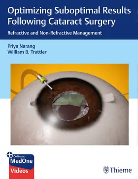 Narang / Trattler |  Optimizing Suboptimal Results Following Cataract Surgery | eBook | Sack Fachmedien