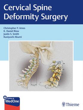 Ames / Riew / Smith |  Cervical Spine Deformity Surgery | Buch |  Sack Fachmedien