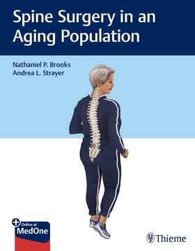 Brooks / Strayer |  Spine Surgery in an Aging Population | Buch |  Sack Fachmedien