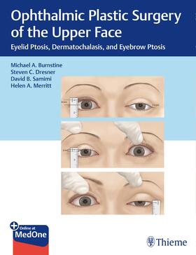 Burnstine / Dresner / Samimi |  Ophthalmic Plastic Surgery of the Upper Face | Buch |  Sack Fachmedien