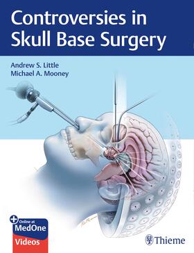 Little / Mooney |  Controversies in Skull Base Surgery | Buch |  Sack Fachmedien