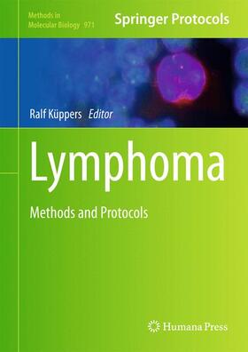 Küppers |  Lymphoma | Buch |  Sack Fachmedien