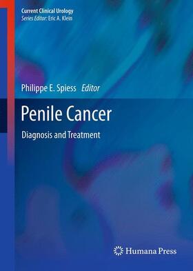 Spiess |  Penile Cancer | Buch |  Sack Fachmedien