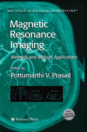 Prasad |  Magnetic Resonance Imaging | Buch |  Sack Fachmedien