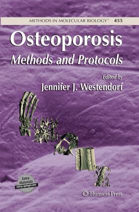 Westendorf |  Osteoporosis | Buch |  Sack Fachmedien
