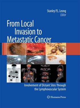 Leong |  From Local Invasion to Metastatic Cancer | Buch |  Sack Fachmedien