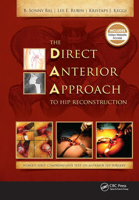 Bal / Rubin / Keggi |  The Direct Anterior Approach to Hip Reconstruction | Buch |  Sack Fachmedien