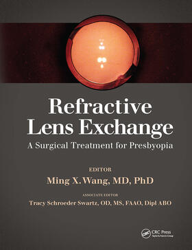 Wang |  Refractive Lens Exchange | Buch |  Sack Fachmedien