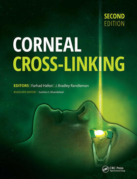 Hafezi / Randleman |  Corneal Cross-Linking | Buch |  Sack Fachmedien