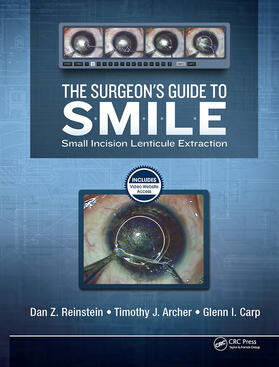 Reinstein / Archer / Carp |  The Surgeon's Guide to SMILE | Buch |  Sack Fachmedien
