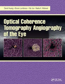 Huang / Lumbroso / Jia |  Optical Coherence Tomography Angiography of the Eye | Buch |  Sack Fachmedien