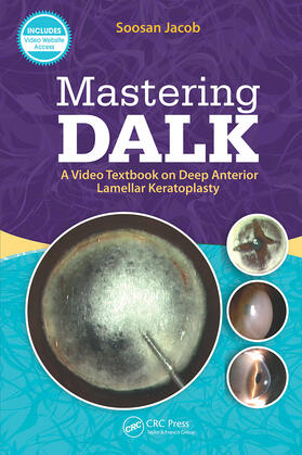 Jacob |  Mastering DALK | Buch |  Sack Fachmedien