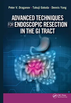 Draganov / Gotoda / Yang |  Advanced Techniques for Endoscopic Resection in the GI Tract | Buch |  Sack Fachmedien