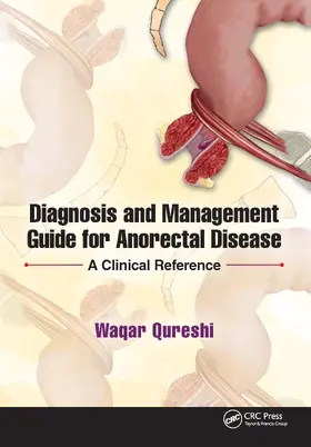 Qureshi |  Diagnosis and Management Guide for Anorectal Disease | Buch |  Sack Fachmedien