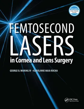 Waring / Rocha |  Femtosecond Lasers in Cornea and Lens Surgery | Buch |  Sack Fachmedien