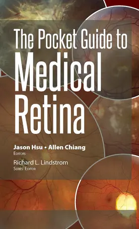 Hsu / Chiang |  The Pocket Guide to Medical Retina | Buch |  Sack Fachmedien