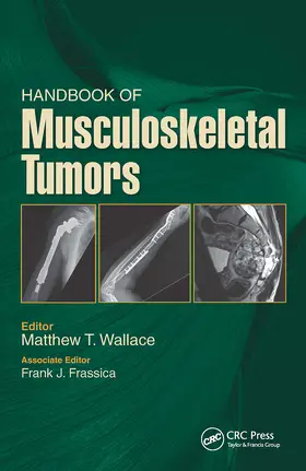 Wallace / Frassica |  Handbook of Musculoskeletal Tumors | Buch |  Sack Fachmedien