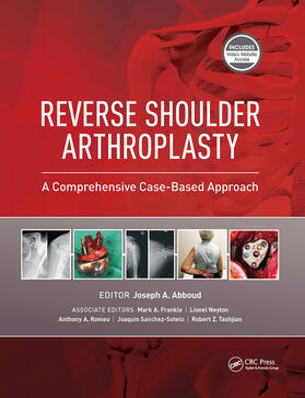 Abboud |  Reverse Shoulder Arthroplasty | Buch |  Sack Fachmedien