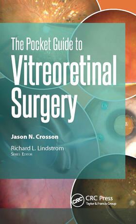 Crosson |  The Pocket Guide to Vitreoretinal Surgery | Buch |  Sack Fachmedien